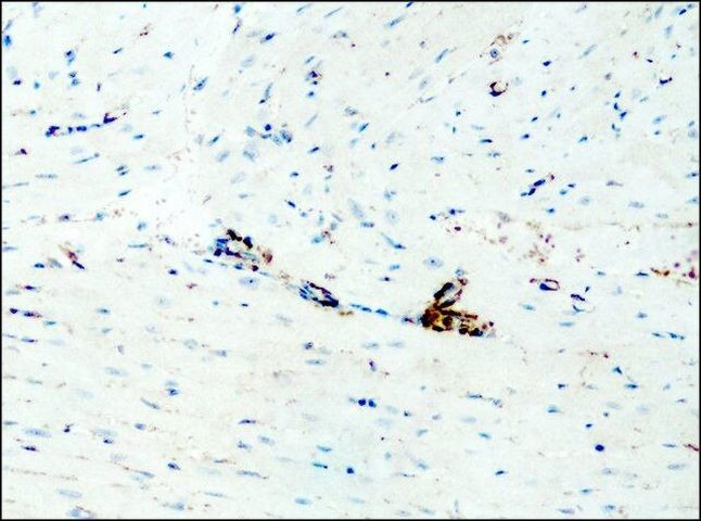 Interaction of IL-38 and DSTN in HEK293T cells. Association of IL-38