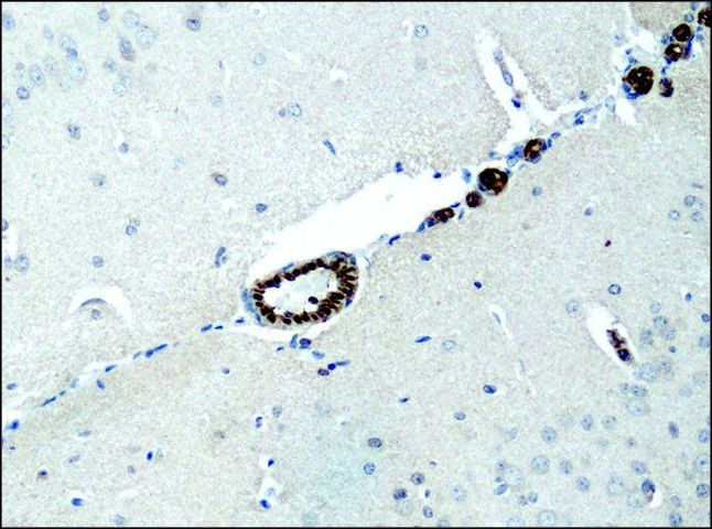 Interaction of IL-38 and DSTN in HEK293T cells. Association of IL-38