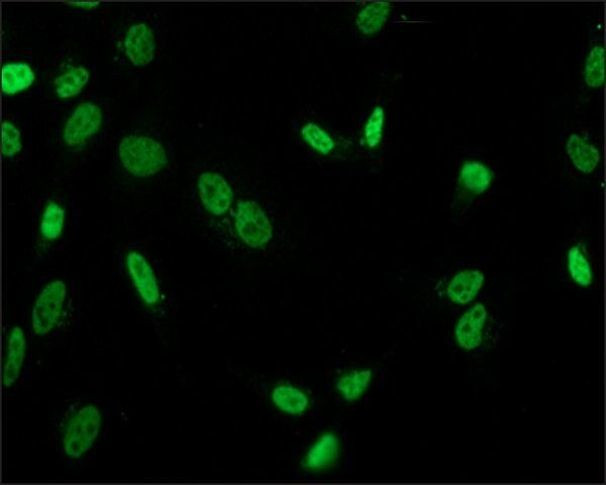 H3K9acS10ph Antibody in Immunocytochemistry (ICC/IF)