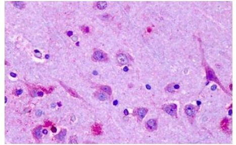 OR6N1 Antibody in Immunohistochemistry (Paraffin) (IHC (P))