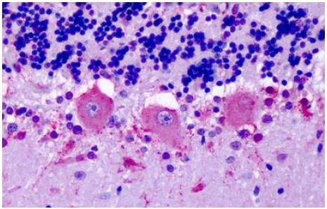 OR6N1 Antibody in Immunohistochemistry (Paraffin) (IHC (P))