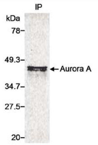 Aurora A Antibody in Immunoprecipitation (IP)