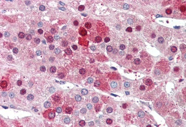 HEC1 Antibody in Immunohistochemistry (Paraffin) (IHC (P))