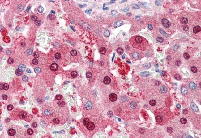 HEC1 Antibody in Immunohistochemistry (Paraffin) (IHC (P))