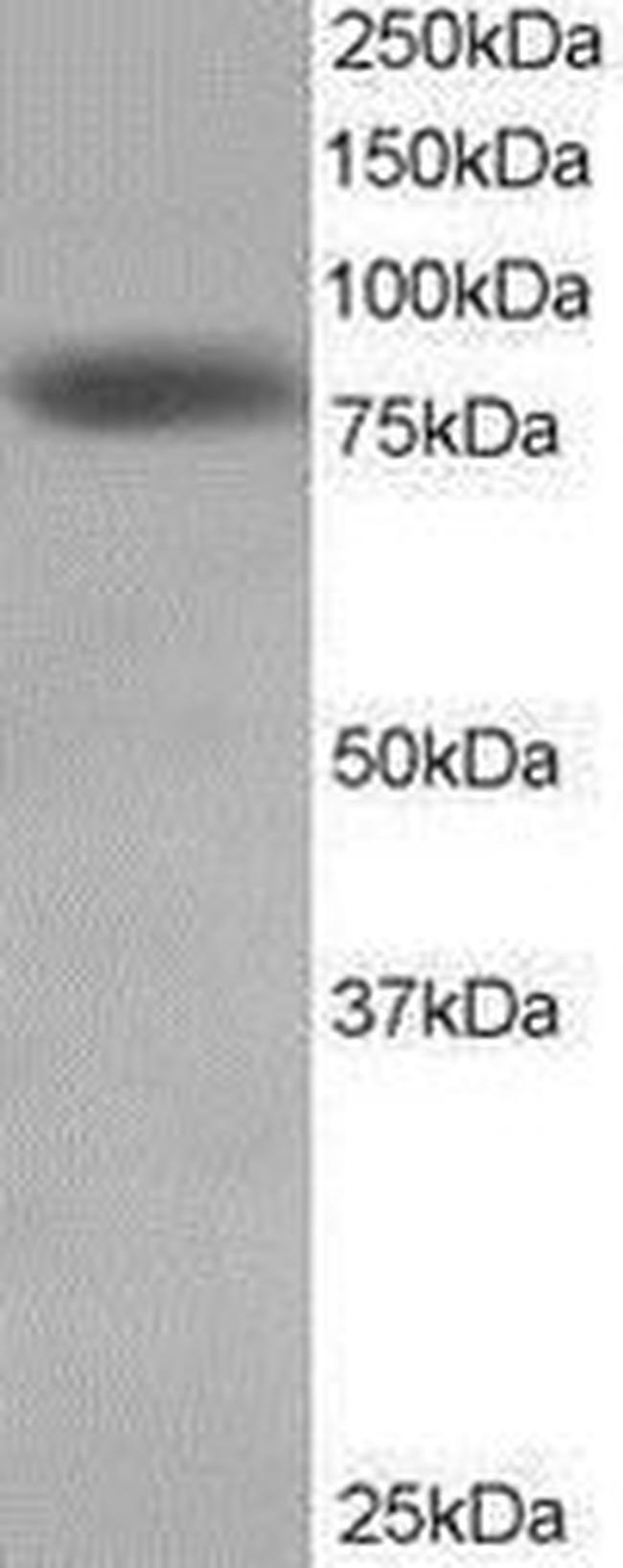 HEC1 Antibody in Western Blot (WB)