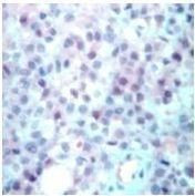 p14ARF Antibody in Immunohistochemistry (Paraffin) (IHC (P))