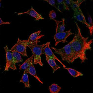 CX3CL1 Antibody in Immunocytochemistry (ICC/IF)