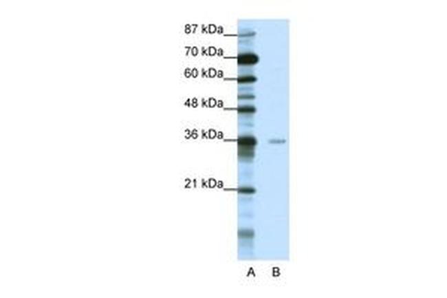 MBD2 Antibody in Western Blot (WB)