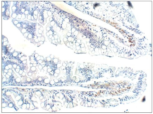 PGCD Antibody in Immunohistochemistry (Paraffin) (IHC (P))