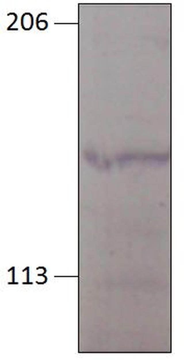 PGCD Polyclonal Antibody (PA1-29492)