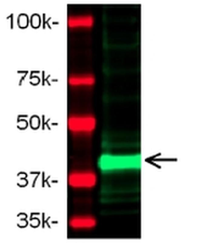 MMP1 Antibody in Western Blot (WB)