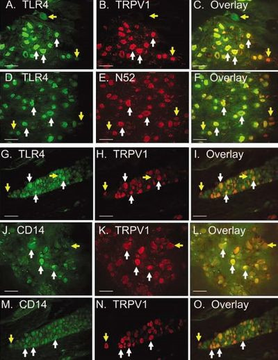 TRPV1 Antibody in Immunohistochemistry (IHC)