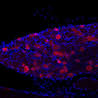 TRPV1 Antibody in Immunohistochemistry (IHC)