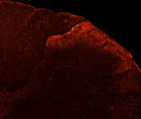 TRPV1 Antibody in Immunohistochemistry (IHC)