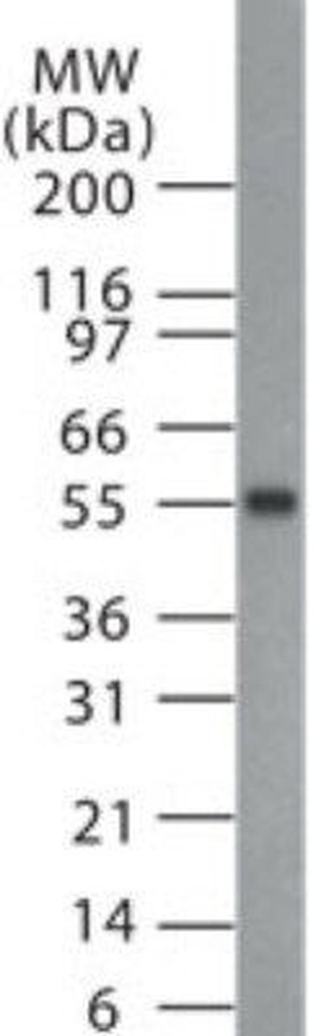 MBD1 Antibody in Western Blot (WB)