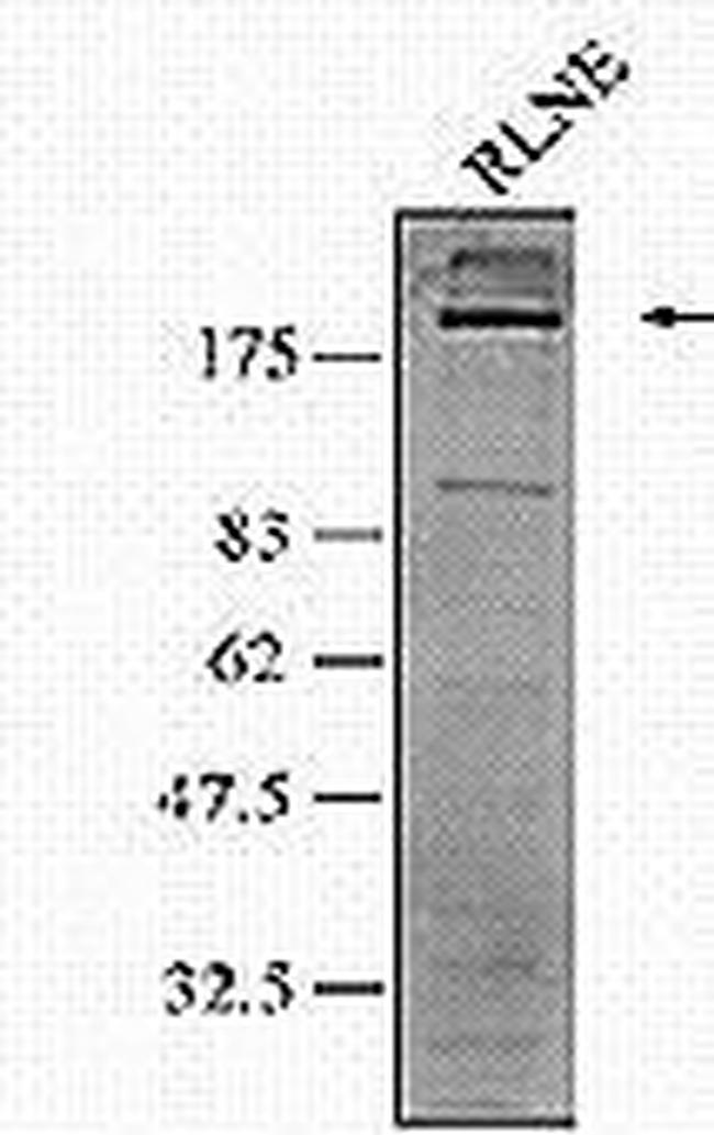 gp210 Antibody in Western Blot (WB)