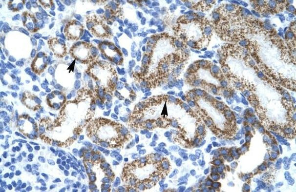 L-Myc Antibody in Immunohistochemistry (Paraffin) (IHC (P))