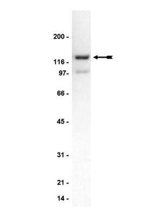 PPP1R9B Antibody in Western Blot (WB)