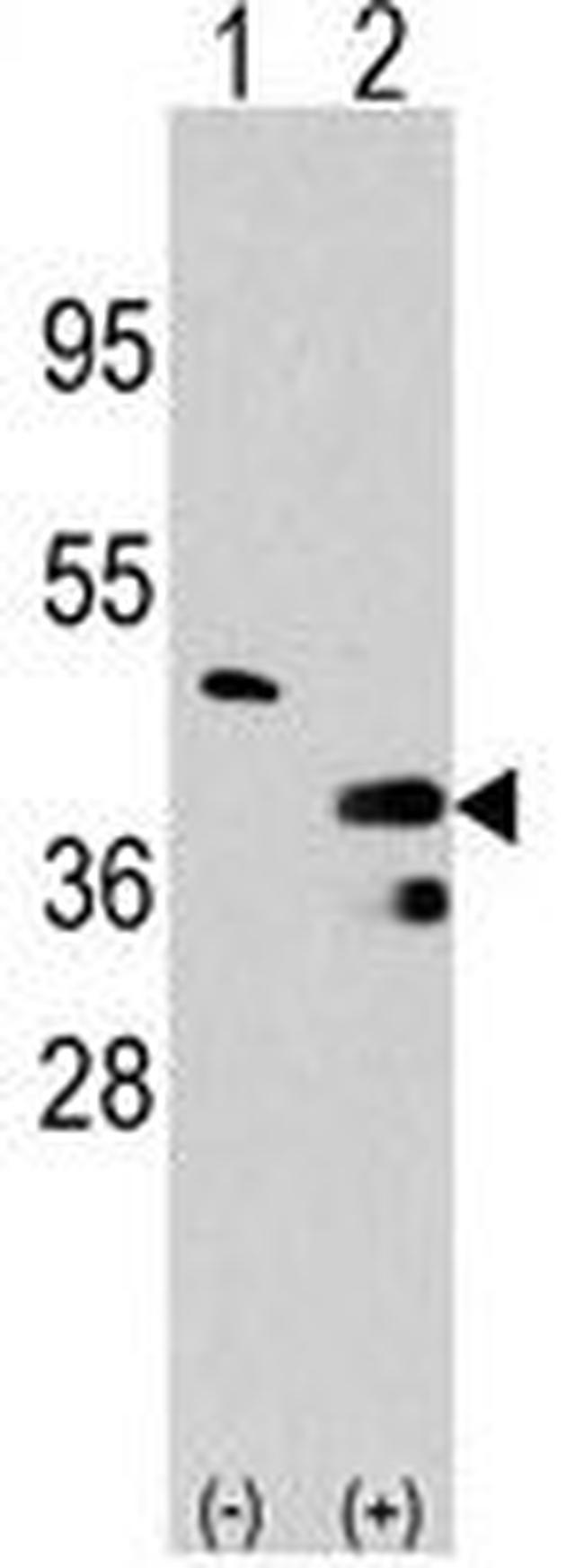 PRMT1 Antibody in Western Blot (WB)