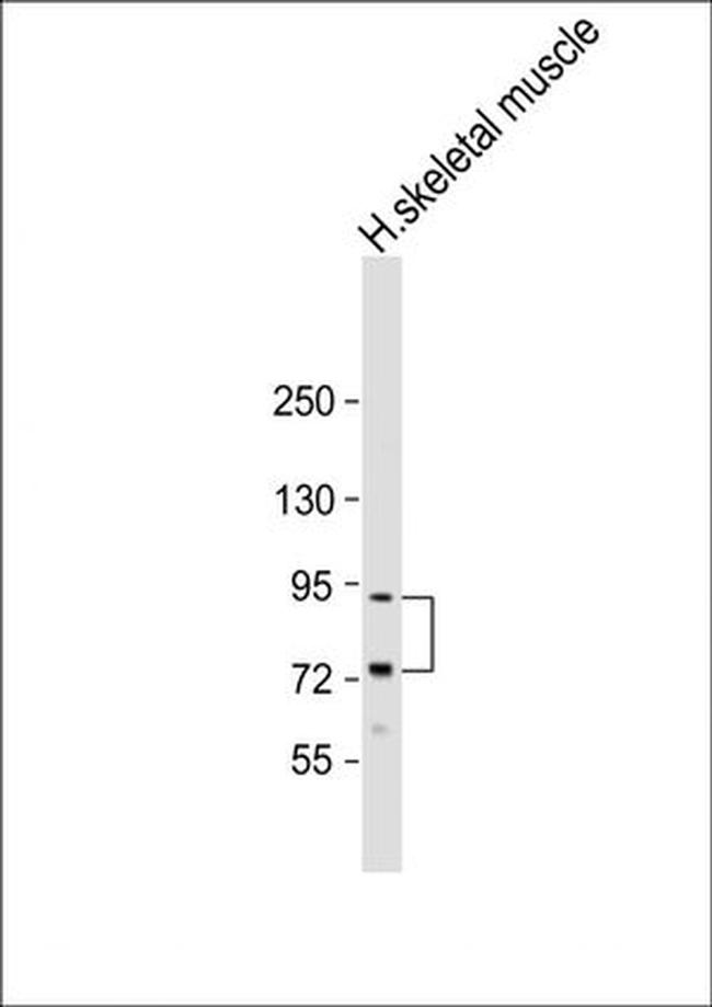 LTK Antibody in Western Blot (WB)