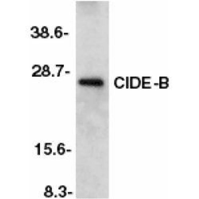 CIDEB Antibody in Western Blot (WB)