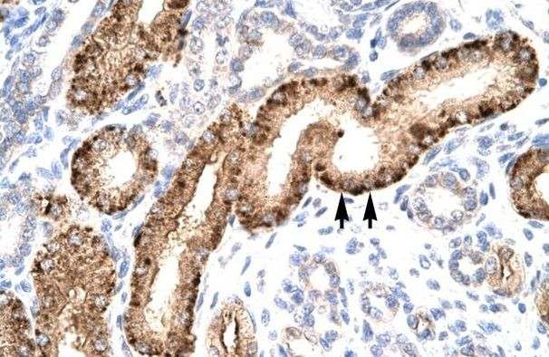 NR5A1 Antibody in Immunohistochemistry (Paraffin) (IHC (P))