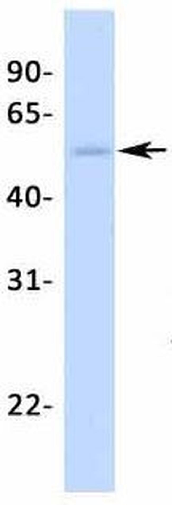 NR5A1 Antibody in Western Blot (WB)