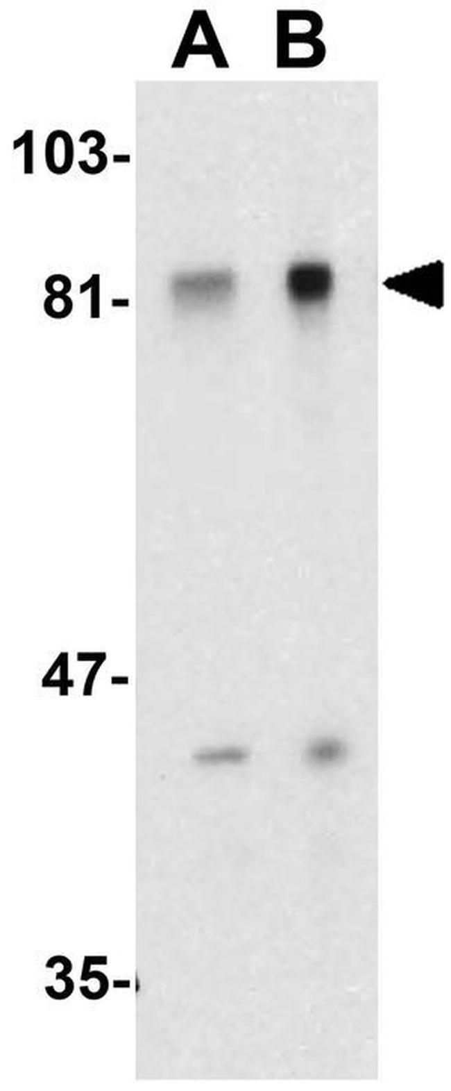 ADAM10 Antibody in Western Blot (WB)