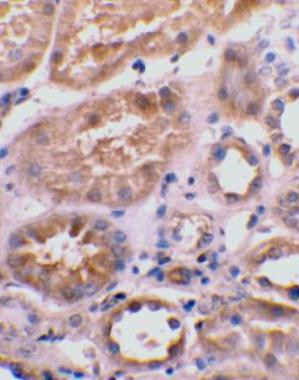 BNIP3L Antibody in Immunohistochemistry (Paraffin) (IHC (P))