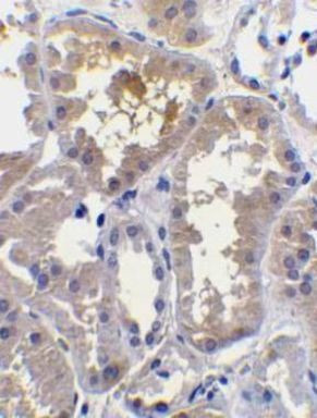 RAIDD Antibody in Immunohistochemistry (IHC)