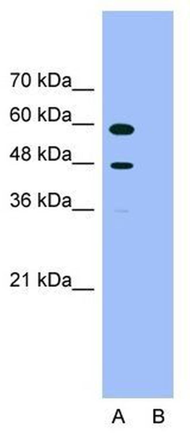 PDCD4 Antibody in Western Blot (WB)