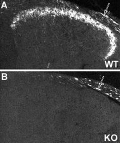 NPY2R Antibody in Immunohistochemistry (IHC)