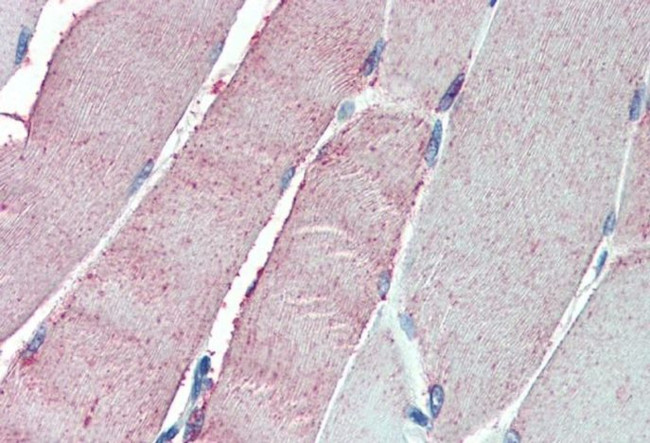 ORP1 Antibody in Immunohistochemistry (Paraffin) (IHC (P))