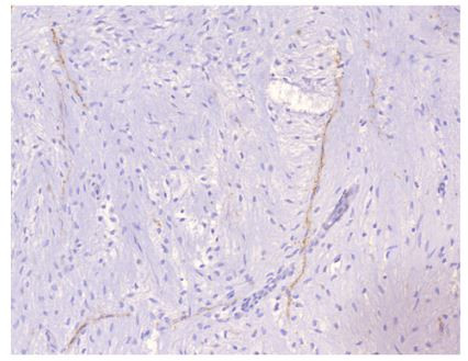 PDE4A Antibody in Immunohistochemistry (Paraffin) (IHC (P))