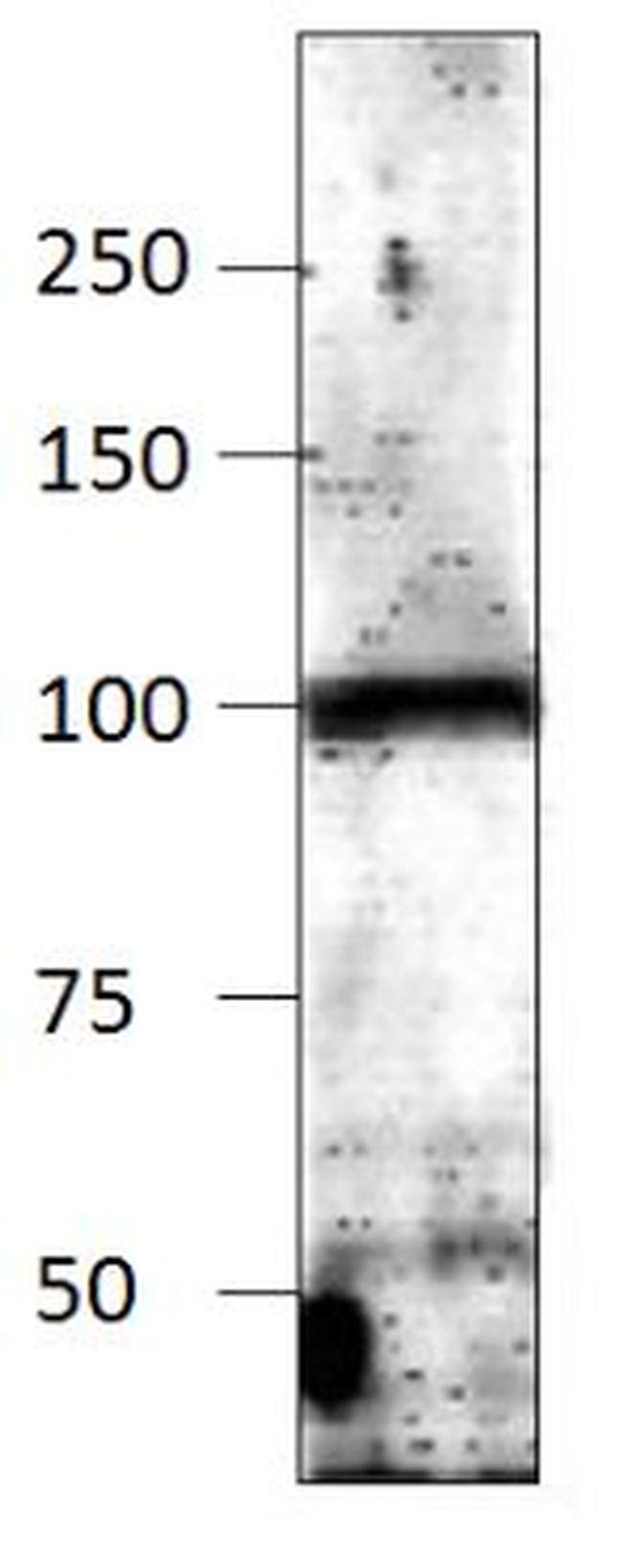 Adenylate Cyclase 9 Antibody in Western Blot (WB)