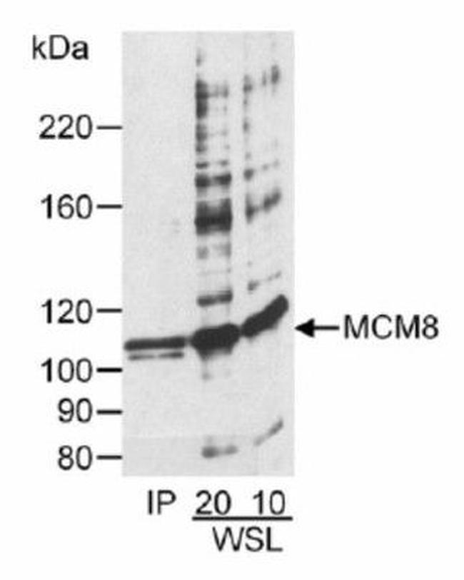 MCM8 Antibody in Western Blot (WB)