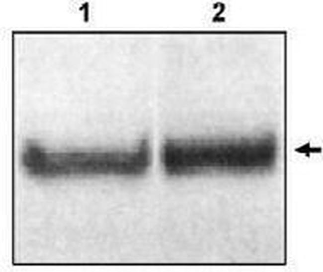 DAB1 Antibody in Western Blot (WB)