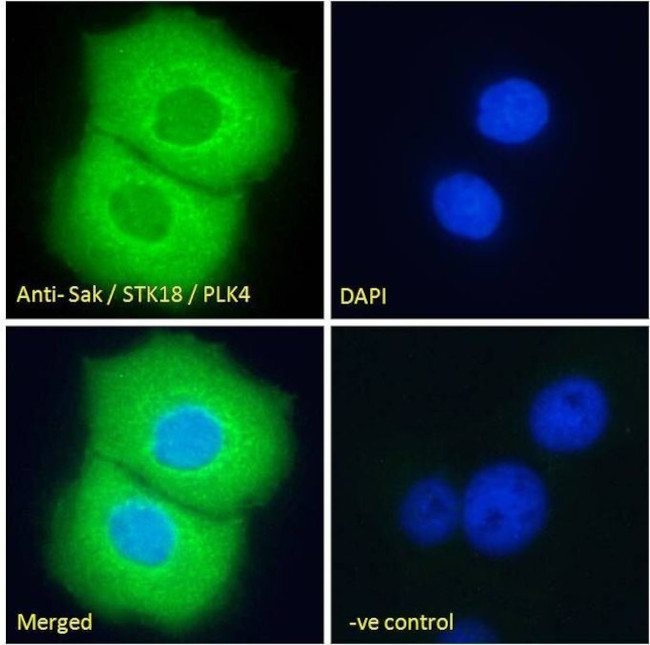 PLK4 Antibody in Immunocytochemistry (ICC/IF)