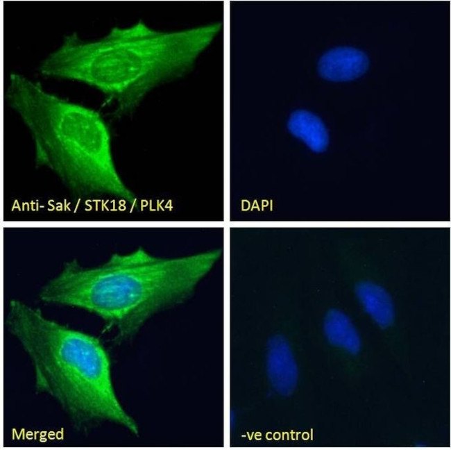 PLK4 Antibody in Immunocytochemistry (ICC/IF)