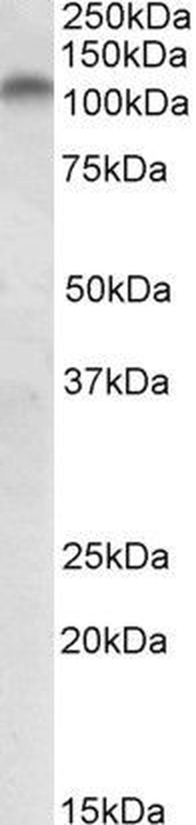 PLK4 Antibody in Western Blot (WB)