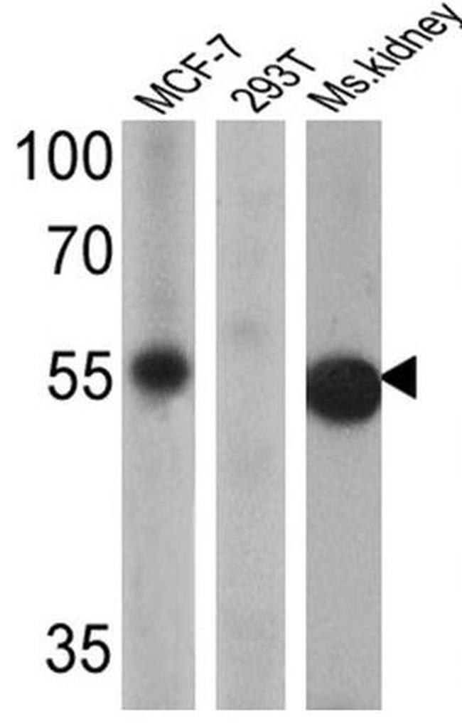 ESRRG Antibody in Western Blot (WB)