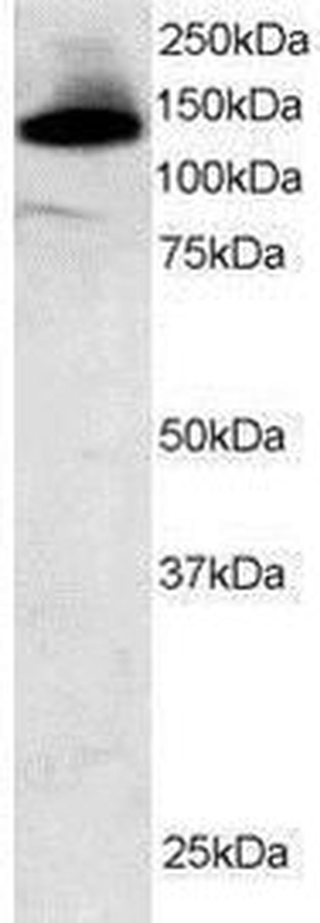 SAP130 Antibody in Western Blot (WB)