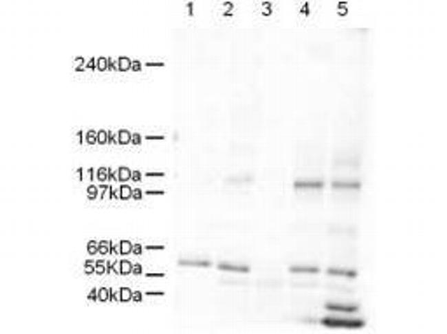 SMARCAL1 Antibody in Western Blot (WB)