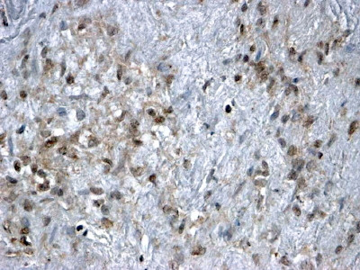 FOXL2 Antibody in Immunohistochemistry (Paraffin) (IHC (P))