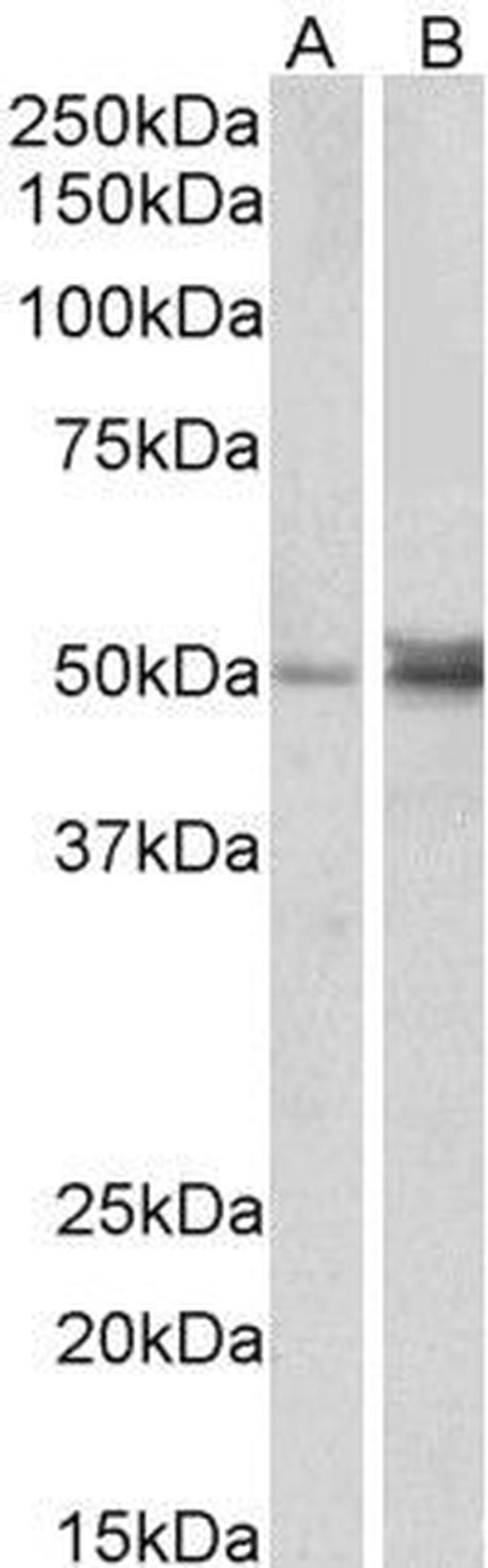 FOXL2 Antibody in Western Blot (WB)