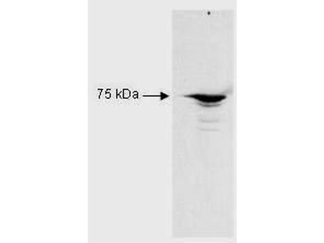 RFX5 Antibody in Western Blot (WB)