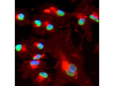 BMI-1 Antibody in Immunocytochemistry (ICC/IF)