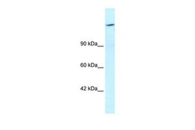 ARID4A Antibody in Western Blot (WB)