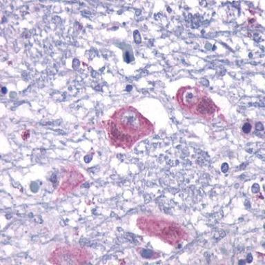 PTH2R Antibody in Immunohistochemistry (Paraffin) (IHC (P))