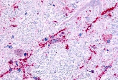 alpha-1b Adrenergic Receptor Antibody in Immunohistochemistry (Paraffin) (IHC (P))